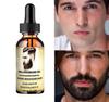Remove Men's Facial Stubble, Fade Beard, Cheeks, and Lip Hair