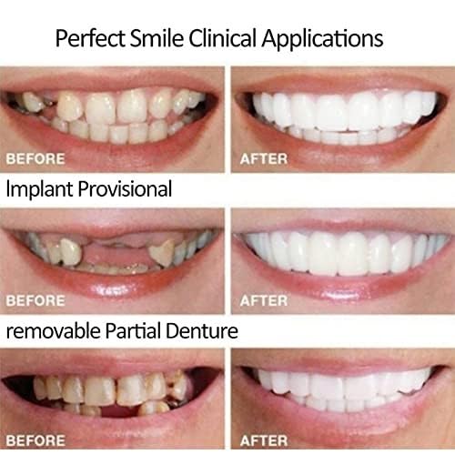 Dentures for Men and False Teeth Temporary Repair Denture Easy To Adjustable and Practical Whitening for Teeth Dentures, Women, Self-made Adhesive,
