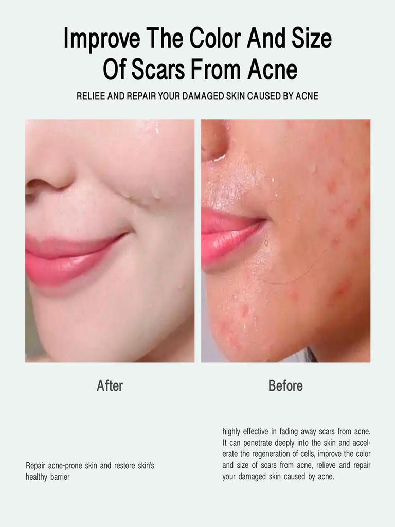 Увлажняющий крем для лица против морщин и тонких линий, укрепляющий крем для глаз