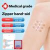 1Pcs Fast Suture Zipper Band-Aid Zipper Tie Wound Closure Patch Hemostatic Patch Wound Outdoor Portable