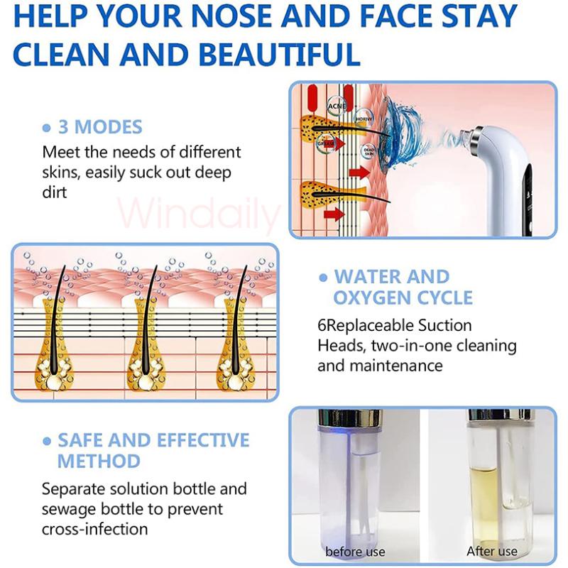 2024 Blackhead Remover Pore Vacuum Cleaner Electric Micro Small Bubble Facial Cleasing Machine USB Rechargeable Beauty Device