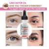 Eye Serum For Styes Chalazion And Blepharitis, Cleanses Lashes And Eyes,Healthier Eye Skin 20ml