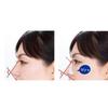 U-Shaped Nose Clip 3D Nose Bridge Heightening Device To Reduce Nose Alar Nose Corrector