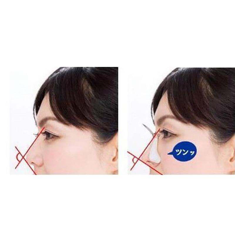 U-Shaped Nose Clip 3D Nose Bridge Heightening Device To Reduce Nose Alar Nose Corrector