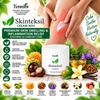 Yvonika Skinteksil Cream-Wax – Premium Skin Swelling & Inflammation Relief, Soothing & Comfort Care, 30 g