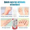 20ml Herbal Foot Spray, Foot Sweat, Foot Odor, Itching Relieving Spray, Odor Peeling Foot Care Spray