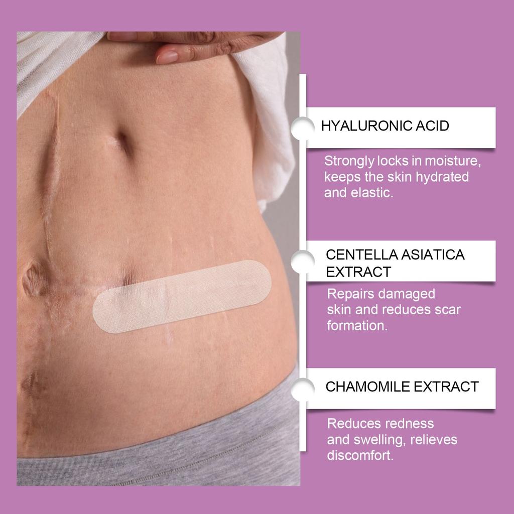 Scar Patch Skin Care Patch Daily Smooth Skin Moisturizing Nourishing Skin Care Patch