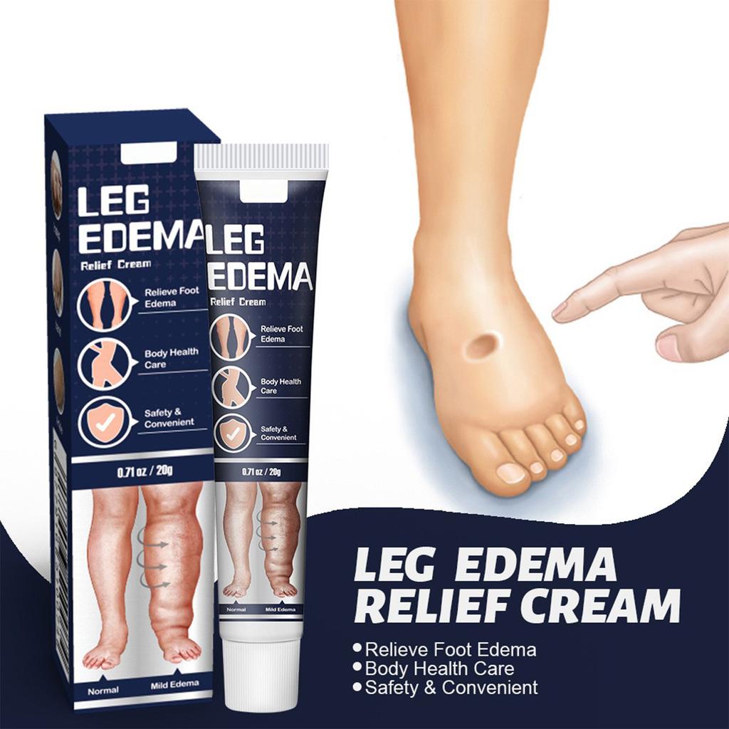 Anti-edema Cream Leg Swelling Edema Cream Arm Calf Foot Massage Health Care Plaster