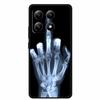 For Xiaomi 15T 5G Case Silicone Luxury Animal TPU Soft Printing Bumper for Xiaomi 15T Pro 5G Starry Sky Scenery Shockproof Cover