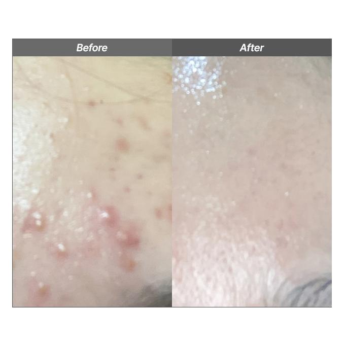 Celladix Очищающий гель Acne Control 131 110 мл