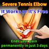 Tennis Elbow Plaster