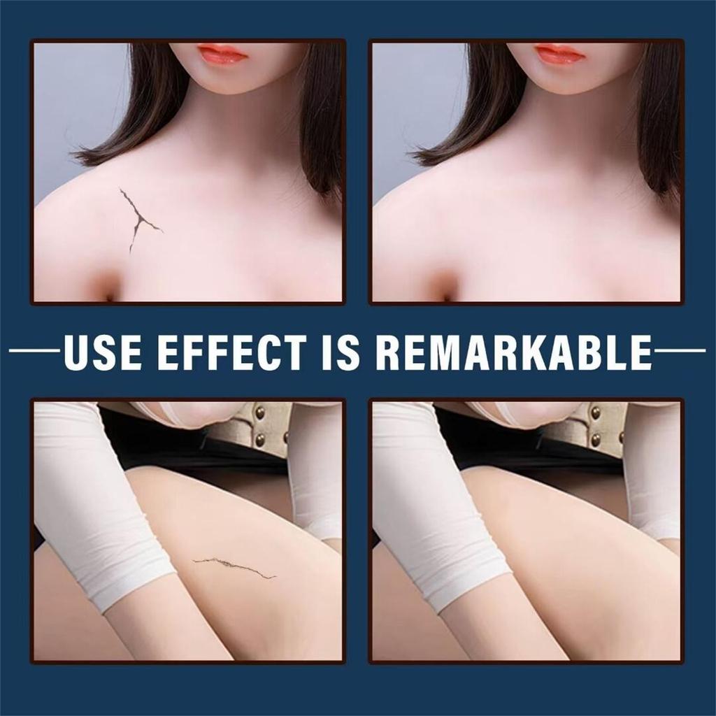 TPE -Glue For Silicone Doll TPE Tear Split Glue 30ml/Bottle