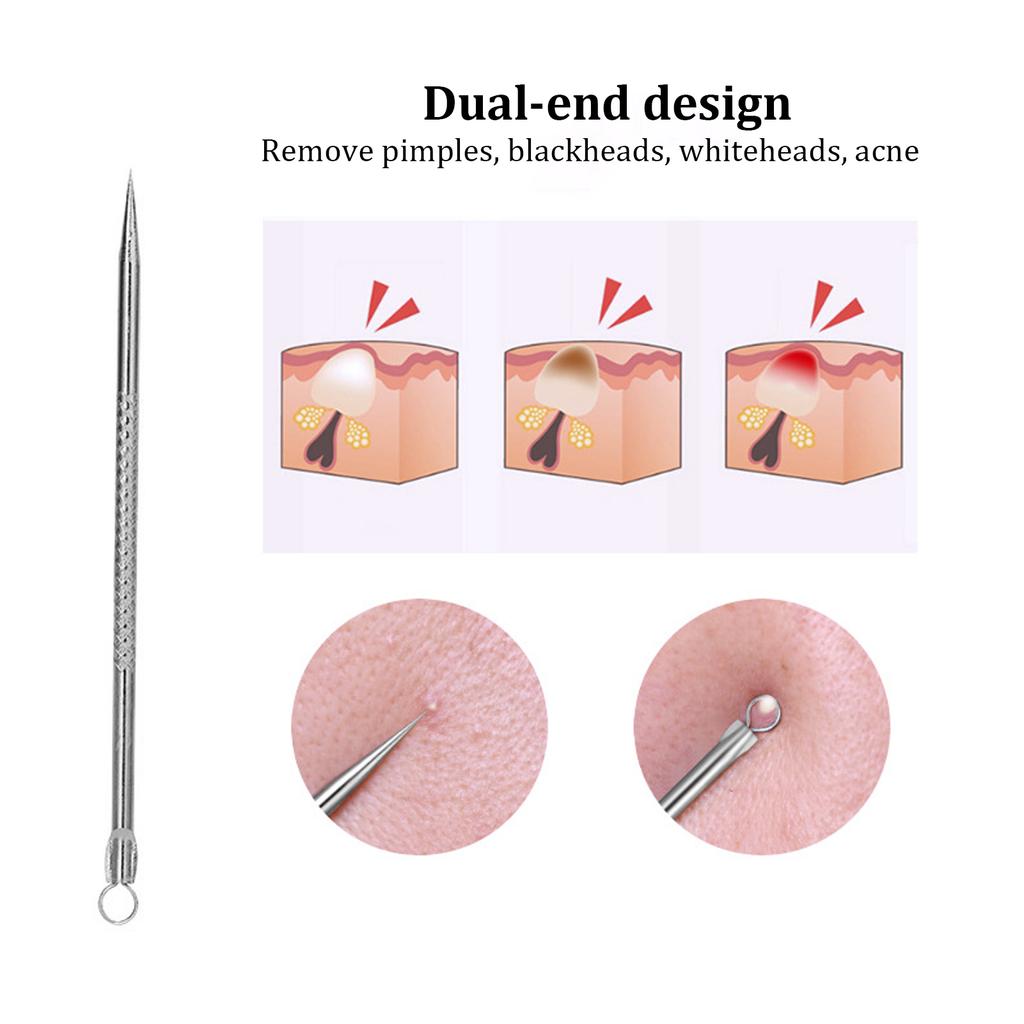 Набор инструментов для удаления черных точек из нержавеющей стали, набор инструментов для удаления волос и прыщей