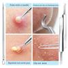 9Pcs Blackhead Remover Kit Stainless Steel Pimple Extractor Set with Storage Box Professional Acne Removal Tools Portable Pore Cleaning