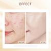 5Pcs Snail Face Mask No Washing Portable Travel Anti Wrinkle Moisturizing Mask