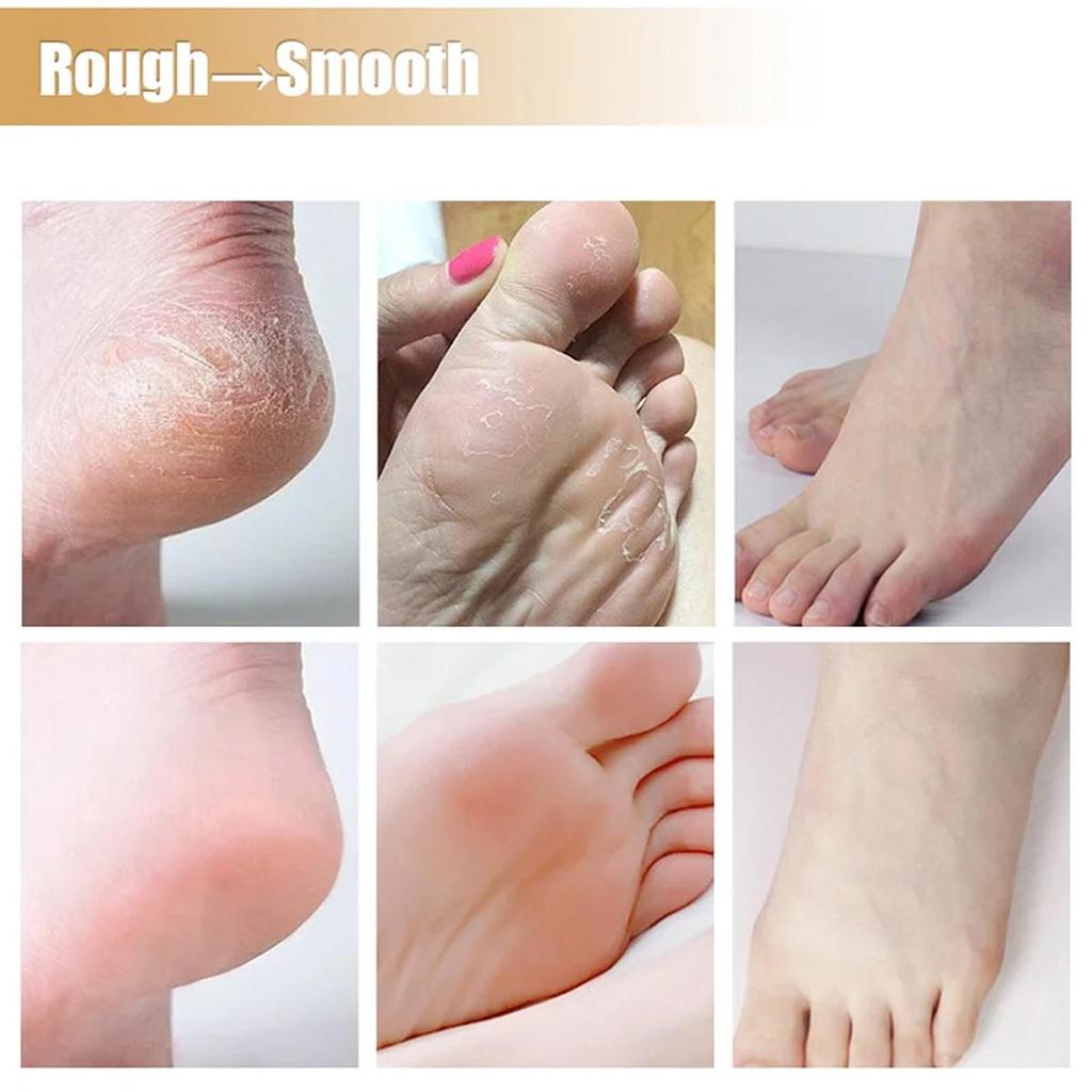 Gentle and Non-irritating, the Chapped Foot Repair Cream Hydrates and Nourishes the Skin, Leaving It Soft and Delicate