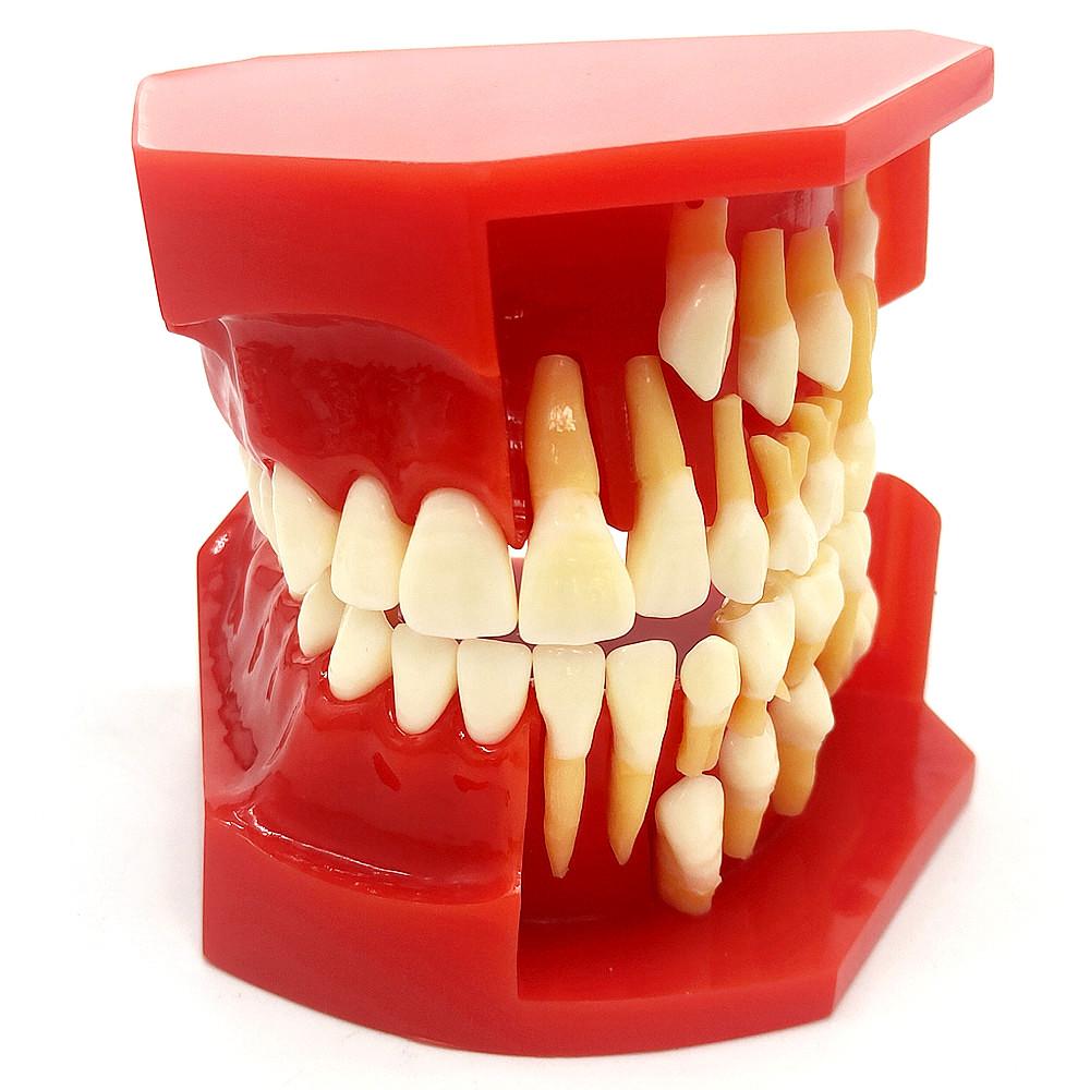Стоматологическая детская модель молочных зубов Сменная модель Постоянные зубы Альтернативный дисплей Съемная демонстрация для обучающих моделей стоматологов