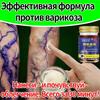 Мазь и крем от варикозного расширения вен на ногах!