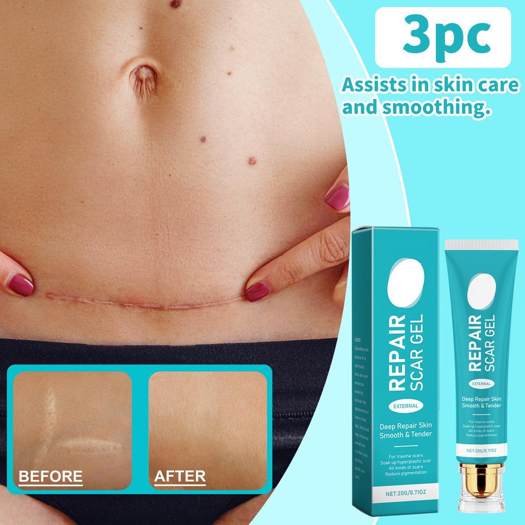 Крем от шрамов, крем для удаления шрамов для мужчин и женщин, разглаживание кожи, укрепление и исчезновение, глубокое разглаживание кожи, нежное внешнее воздействие всех видов