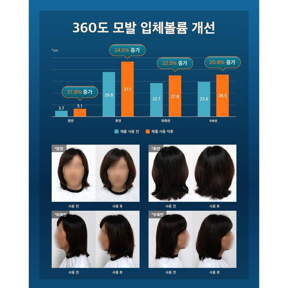 Mozerim Elixir Hair Loss Shampoo Set Mildly Acidic Silicone Free Floral Fragrance 300ml, 1 Set