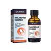 OUHOE Nail Repair Essence Soft Nail Thickening Nail Smoothing Endogenous toenail Nail Fungus Repair Essence