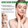 EELHOE Herbal Acne Removal Pen Oil Control Anti-Acne Gel Treatment Acne Mark Skin Care Whitening Eliminate Pimples Facial Cream