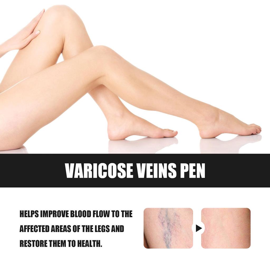 Ручка для лечения варикозного расширения вен Ручка для снятия дискомфорта при вздутии ног Ручка для расслабления ног Ручка для абажурной терапии Ручка для восстановления ног