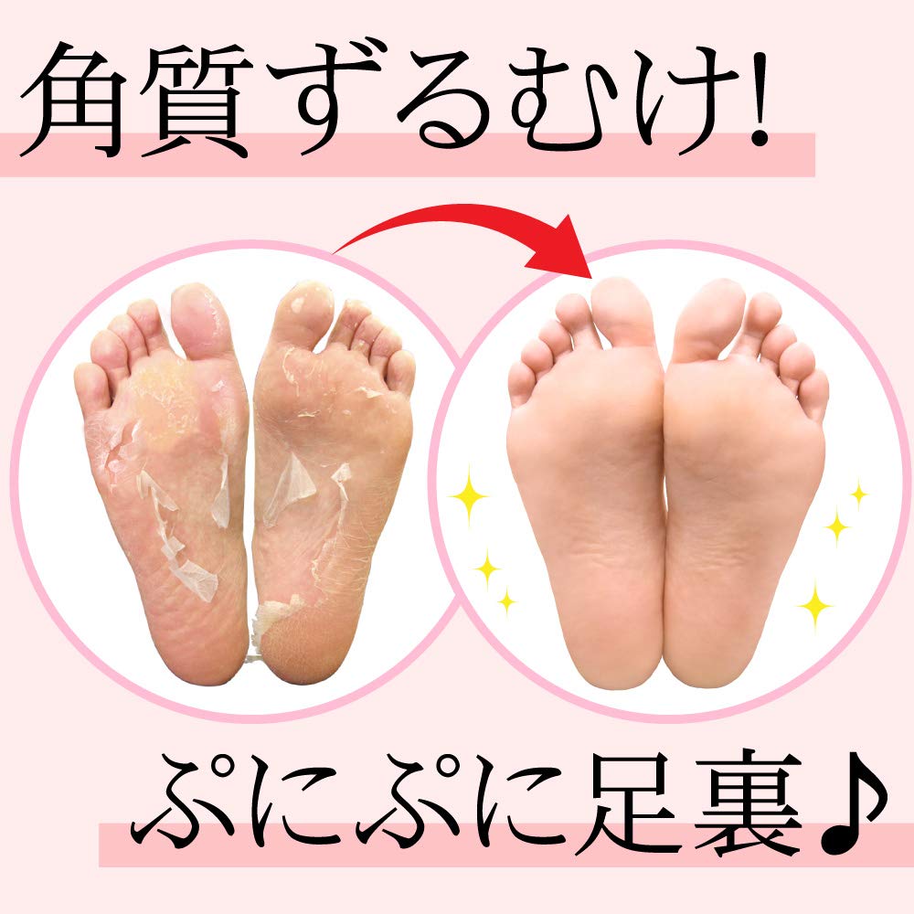 Foot Peeling Pack Perorin Mint x 1 Scratch Smart x 1 Set (2 uses) &