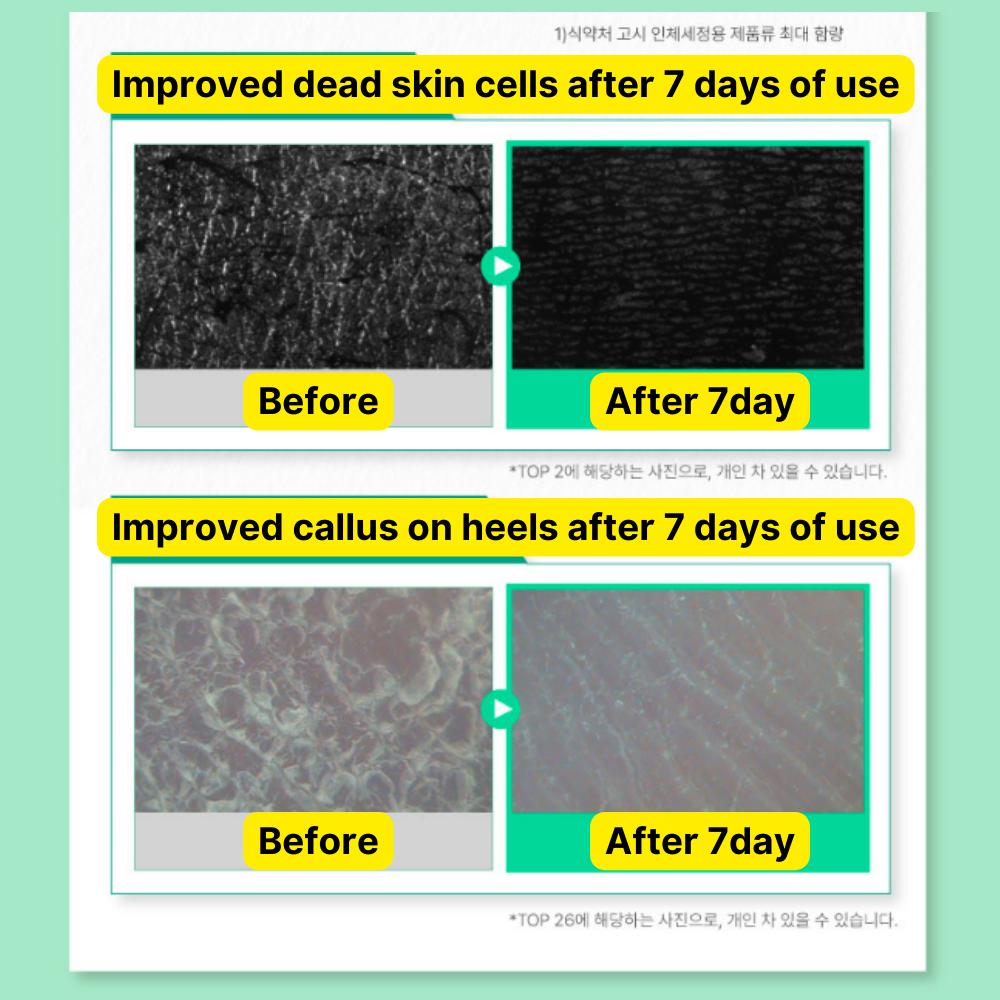 ILLIYOON Cica Acne Clear Peeling Scrub 200 г