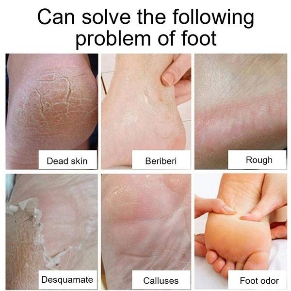 Новейший восстанавливающий увлажняющий крем для кожи рук и ног, против растрескивания, для грубых, сухих и потрескавшихся ног, крем для восстановления пяток