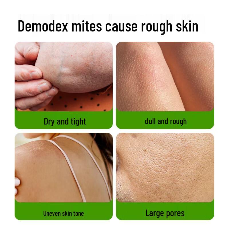 MANTING Питательное мыло против клещей