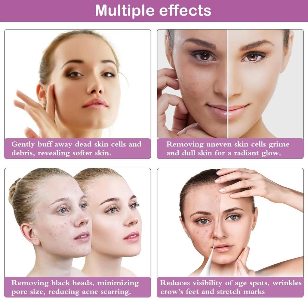 Аппарат для алмазной микродермабразии 65-68 см рт. ст. Мощность всасывания Профессиональное домашнее использование Уход за кожей лица Оборудование для дермабразии