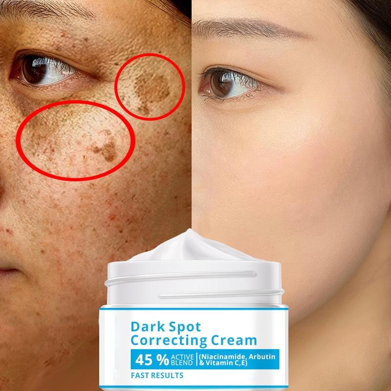 Отбеливающий и осветляющий крем от прыщей, очищающий, осветляющий и уменьшающий пятна, универсальный для мужчин и женщин.