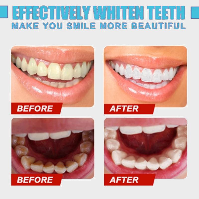 Удаление пятен на зубах Кровотечение десен Отбеливание Глубокая очистка зубного налета Средства гигиены полости рта Свежее дыхание Чистые зубы