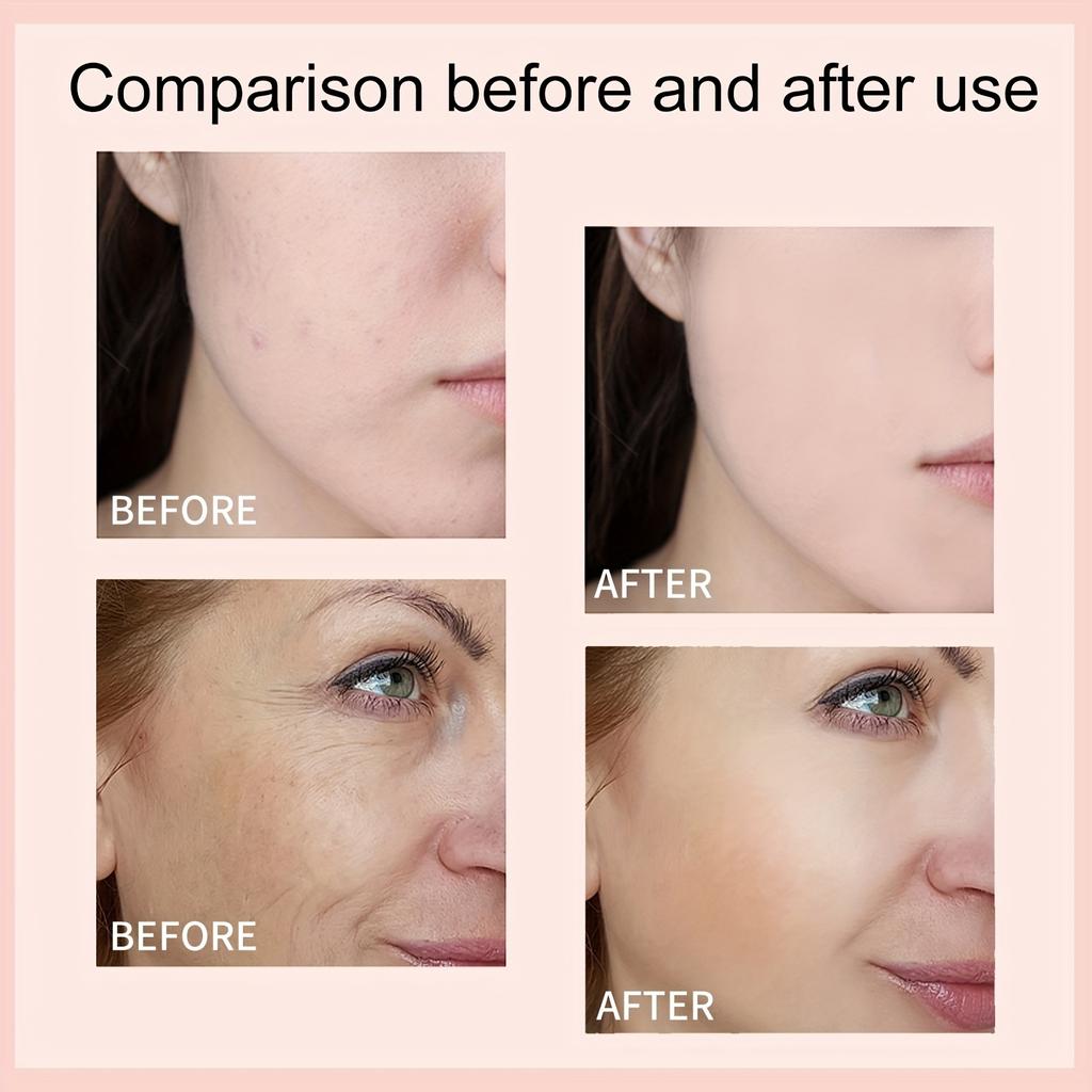 Hydrate & Rejuvenate — сыворотка для лица с гиалуроновой кислотой успокаивает сухую кожу, повышает ее эластичность, борется с прыщами, стирает тонкие линии