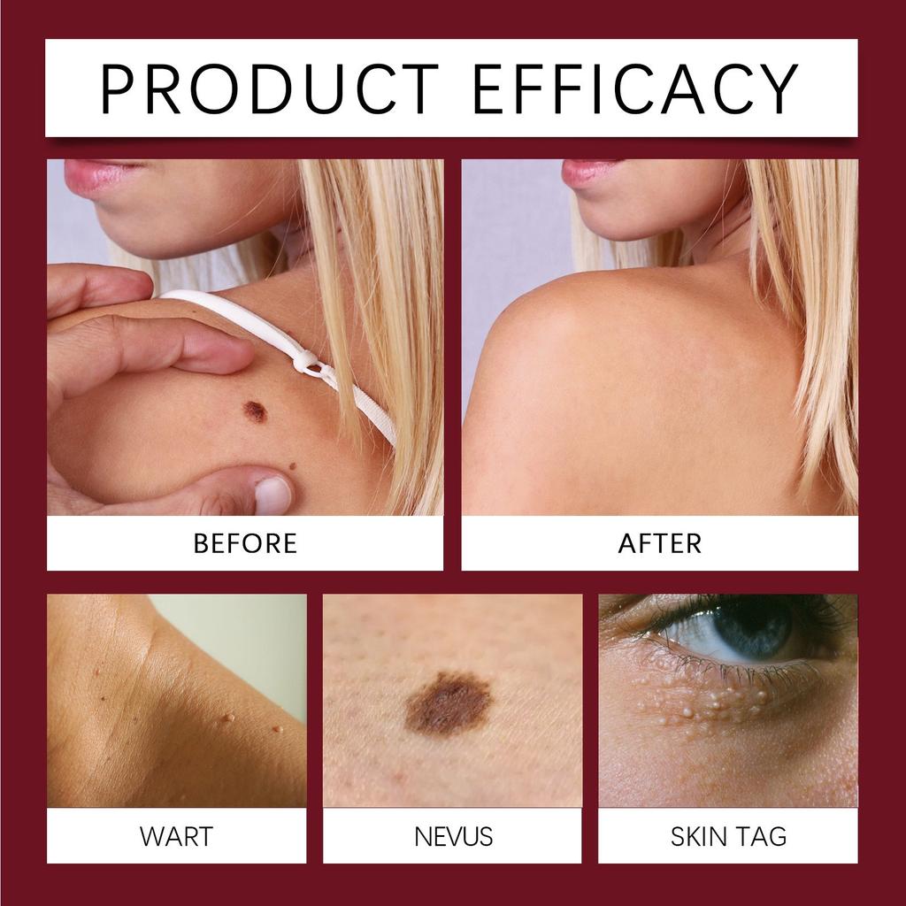 Пластырь для удаления пчел и родинок Пластырь для ухода за кожей Мягкий состав Коллаген Ежедневный уход за кожей