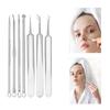 Blackhead Remover Comedone Squeezer Set Stainless Steel Pimple Squeezer Tool Acne Pimple Tweezers for Nose Face Care