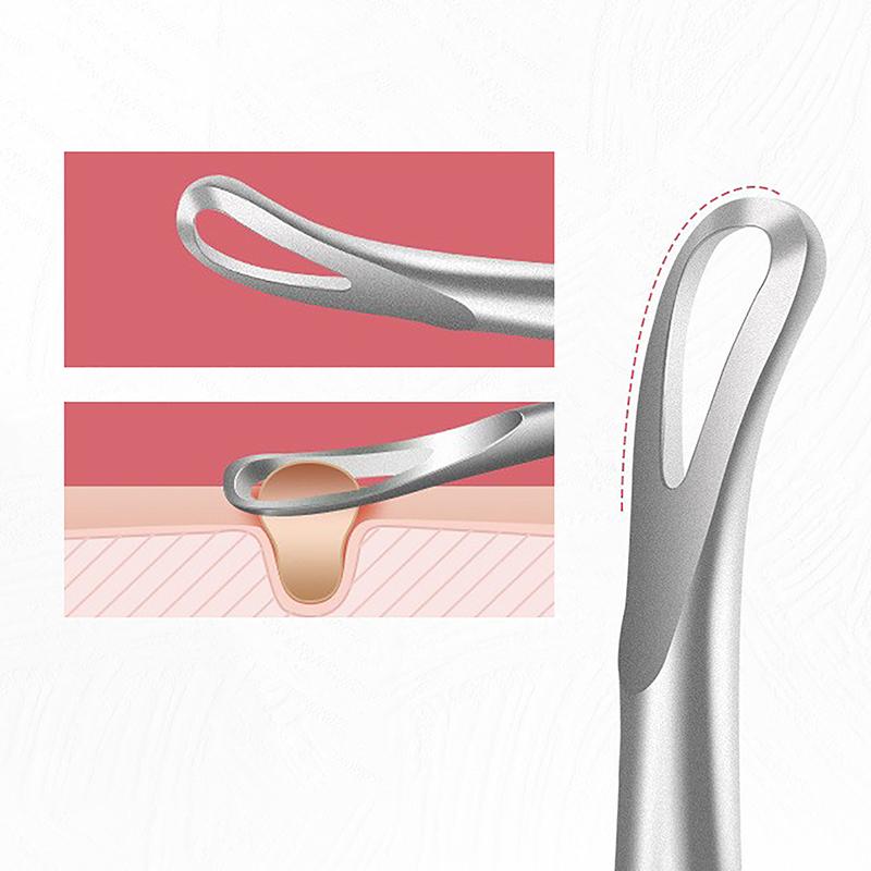 Инструмент для удаления черных точек с черными точками, прыщи, иглы для выдавливания прыщей, инструменты, ложка для чистки лица, экстрактор комедонов, очиститель пор