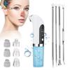 Удаление черных точек, пылесос для чистки пор, электрический очиститель для удаления черных точек, USB-аккумулятор, инструменты для очистки лица с циклом работы от воды