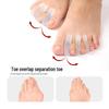 Силиконовый корректор Hallux Valgus и разделитель пальцев ног с трехлуночным дизайном, подходит для ношения в обуви