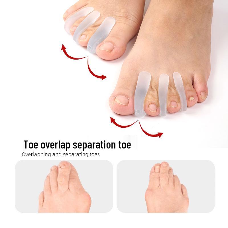Силиконовый корректор Hallux Valgus и разделитель пальцев ног с трехлуночным дизайном, подходит для ношения в обуви