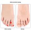 2pcs Toe Separator Finger Protector Applicator Corn Callus Remover Bunion Corrector Pedicure Tools Pain Relief Tube Foot Care