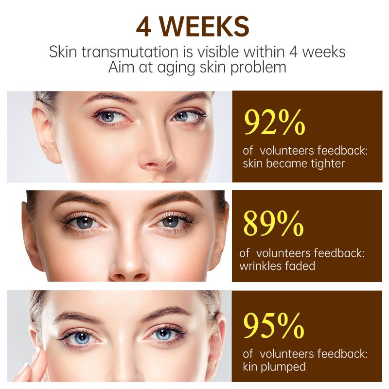 JoyPretty Сыворотка для лица VC отбеливающая ретинол морщины чайное дерево лечение акне для темной кожи лица корейские средства по уходу за кожей