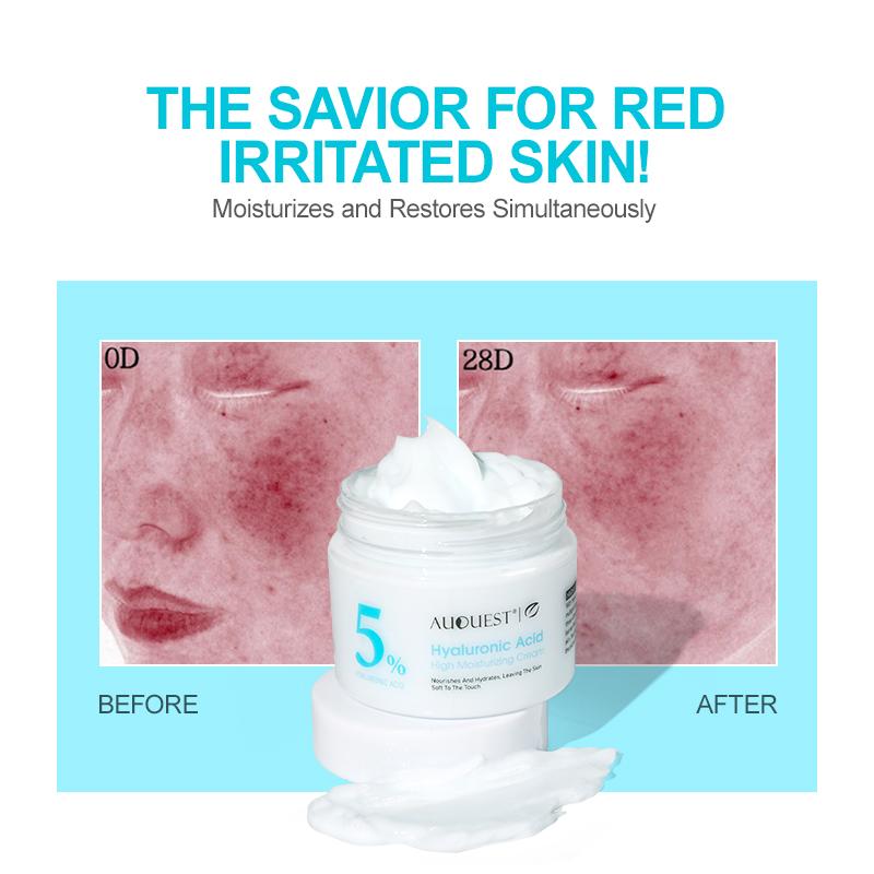 Увлажняющий крем для лица с гиалуроновой кислотой, длительное увлажнение, удаление расширенных пор, увлажняющий крем для сухой кожи лица, уход за кожей