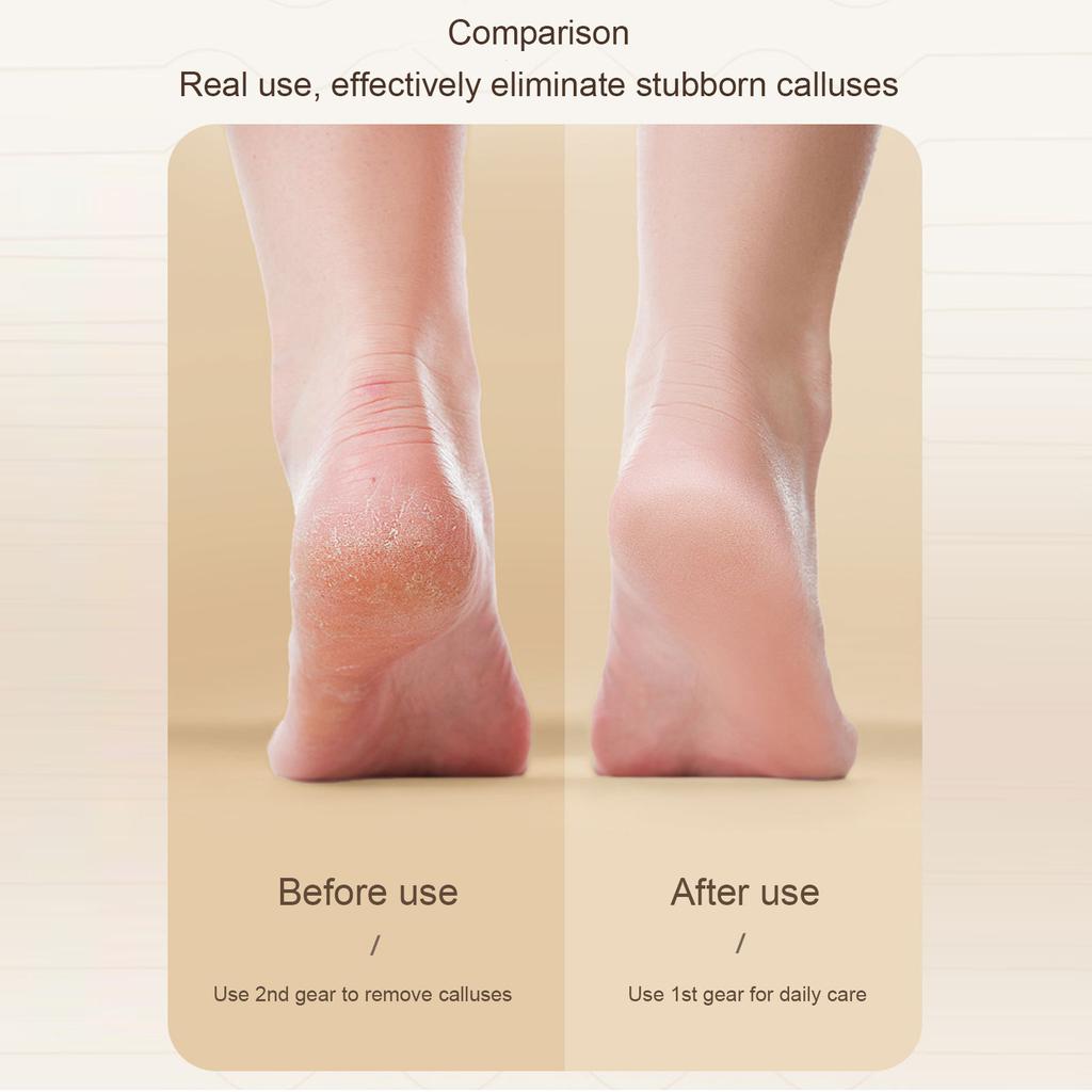 4pcs Silicone Landing Gear Shock Pad for T40 T30 T20P Drones Accessories Buffer Foot Pad Repair Part