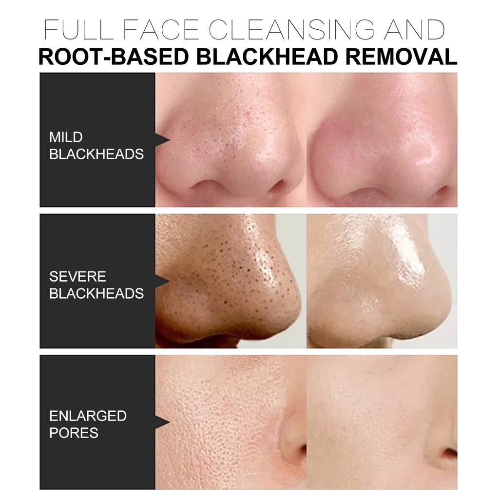 Маска для носа с черными точками и клубникой, очищающее масло для носа, средство от прыщей и угрей, набор для ухода за Т-зоной