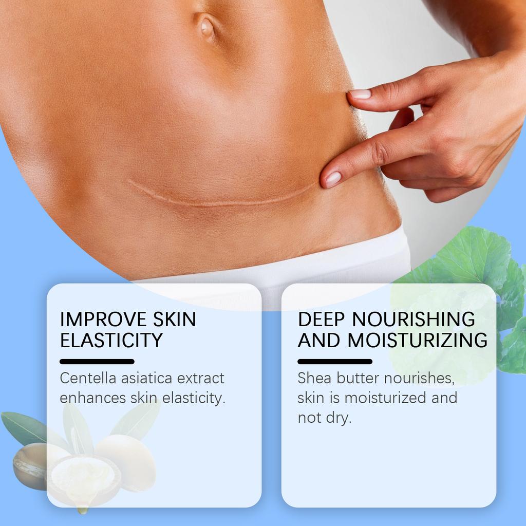 Ухаживающий гель от акне, растяжек, пигментных пятен беременности, отложения меланина, мягкий и успокаивающий, эффективно осветляет следы от шрамов