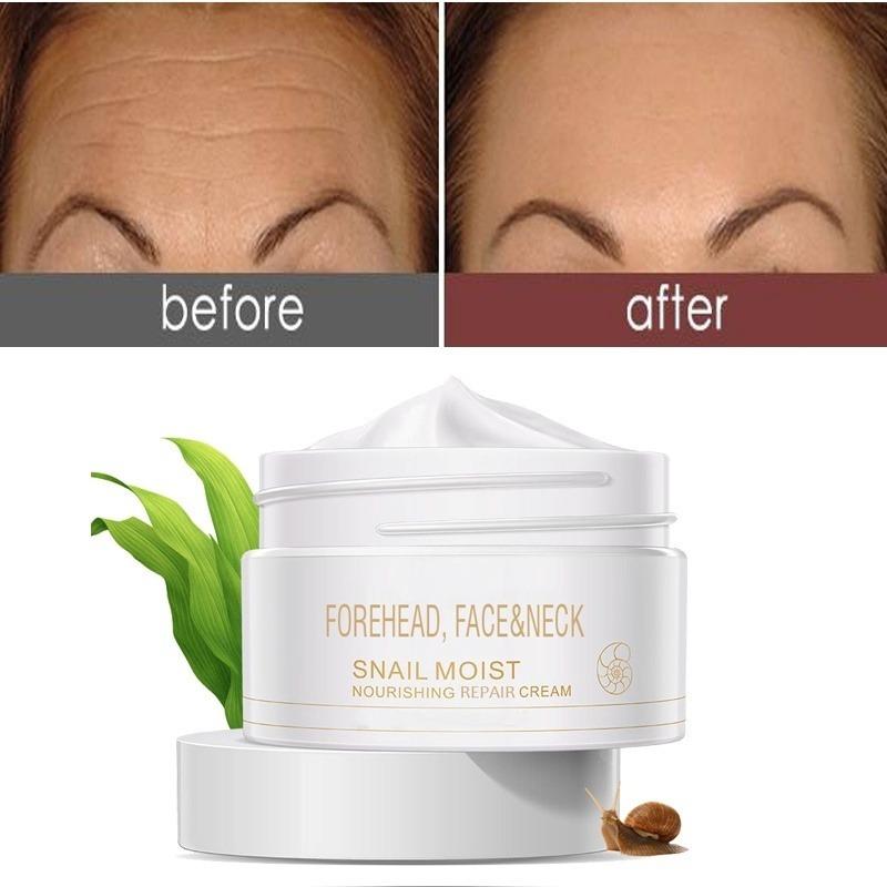 Крем для удаления и отбеливания морщин улитки