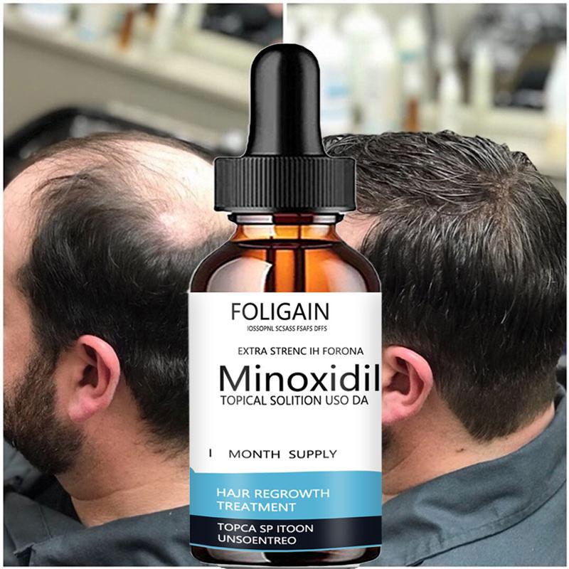 Hair Conditioner Anti Hair Loss Essence Hair Growth More Luxuriant Nourishing Hair Moisturizing Hair Essence