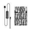 Dental Sensor With Holder Faster/Recycle/Durable USB Dental X Ray Sensor Intra Oral Camera Digital RVG Sensor